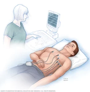 pessoa realizando exame eletrocardio